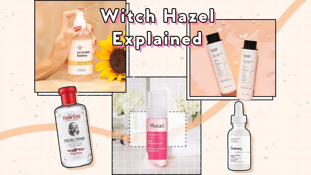 Hazel help acne will witch Witch Hazel