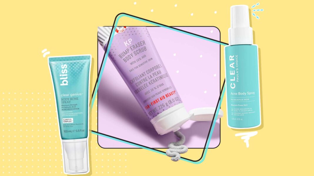 9 Best Body Acne Treatments to Make It Go Away for Good