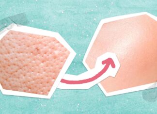 Minimize Pores With These 5 Tips