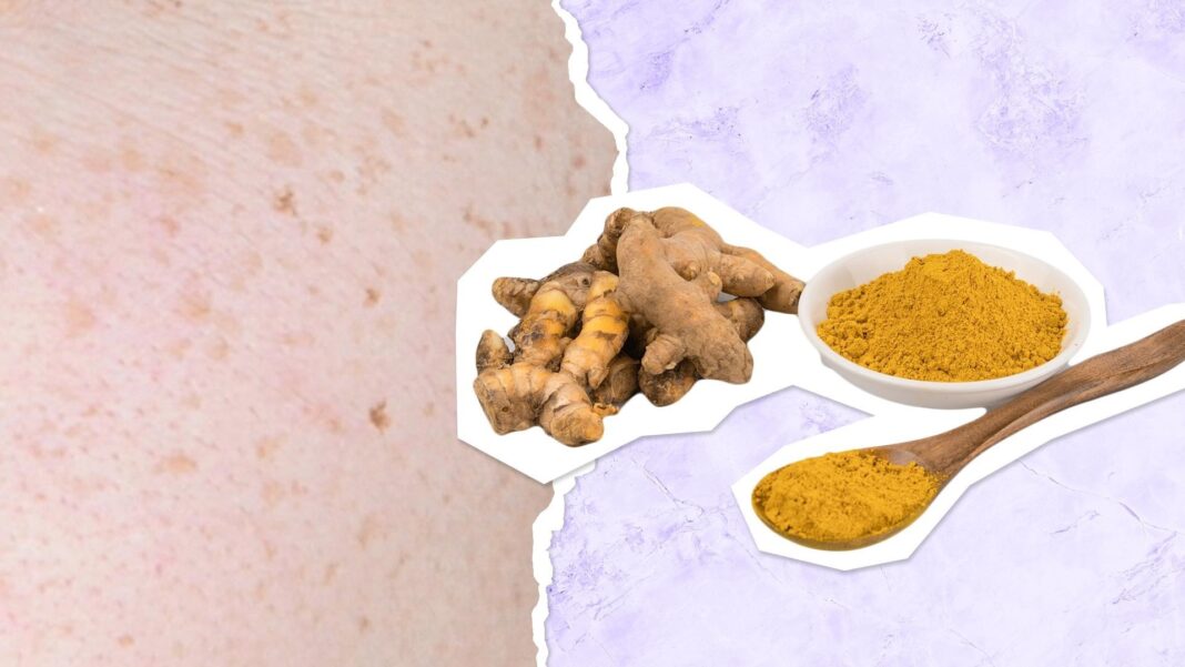 Amazing Turmeric Benefits for Skin & How to Use Turmeric for Dark Spots & Hyperpigmentation