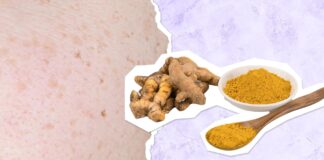 Amazing Turmeric Benefits for Skin & How to Use Turmeric for Dark Spots & Hyperpigmentation